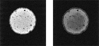 Obrazy MRI przekroju przez ser dla protokołu PDW (a) i T2W (b)