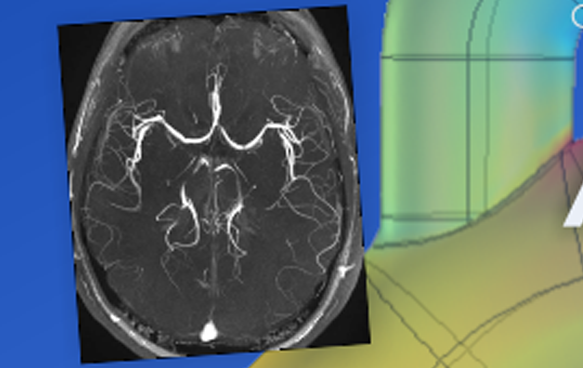 MRI angiography simulator