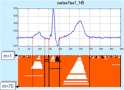 P. Strumiłło, "Nested median filtering for detecting T-wave offset in ECGs"