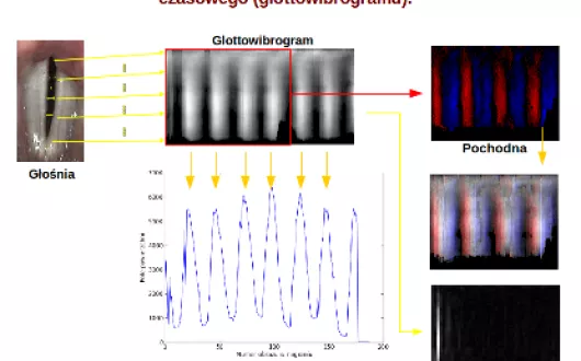 Wideostroboskopia krtani