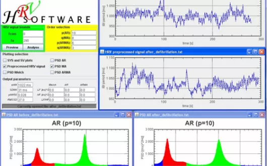 Okno graficznego interfejsu użytkownika programu do analizy sygnału zmienności rytmu serca