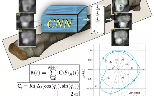 Wykorzystanie głębokiego uczenia i B-splajnów do modelowania światła naczyń krwionośnych na podstawie obrazów 3D