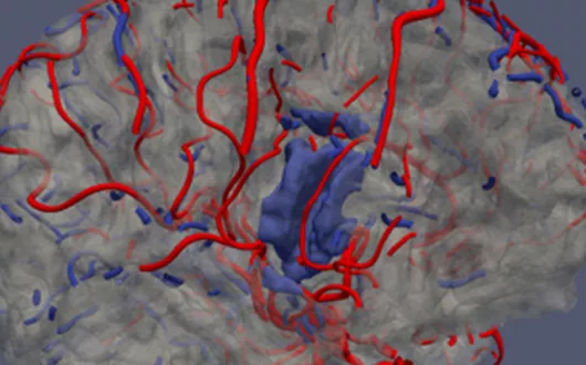 Geometric modeling of blood vessels