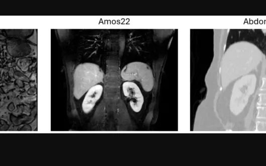 Zdjęcie z artykułu "Frugal Learning Methods for Kidney Segmentation in Non-Contrast MRI"