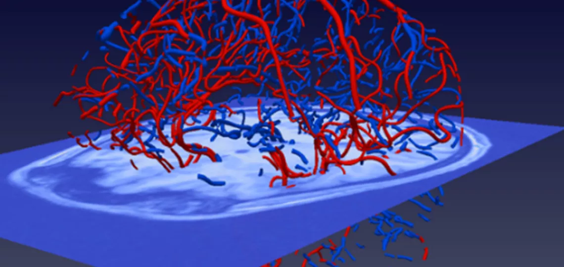 Analiza obrazów i sygnałów biomedycznych