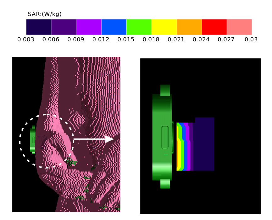 Design and Analysis of a Smart Watch Antenna Operating in the 2.4 GHz Band