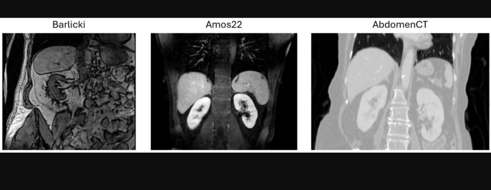 Zdjęcie z artykułu "Frugal Learning Methods for Kidney Segmentation in Non-Contrast MRI"